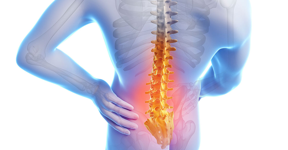 Low Back Pain