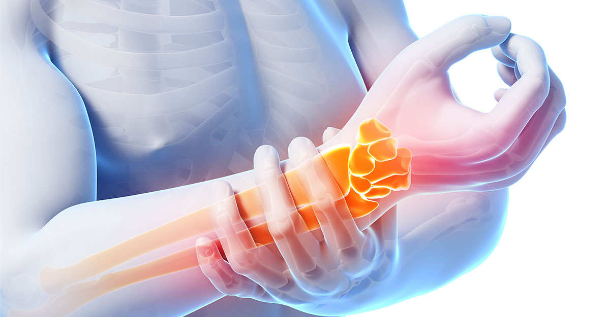 Carpal tunnel dr somerville