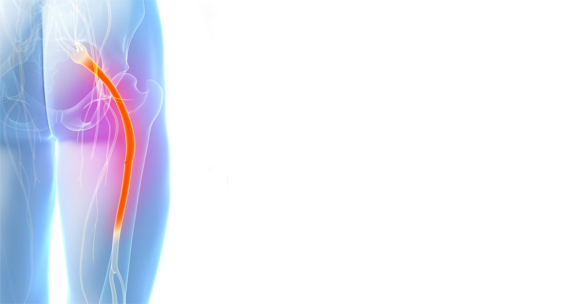 Sciatic Pain Relief Somerville
