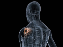 Shoulder Injury Somerville