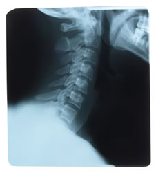 Neck Pain Care