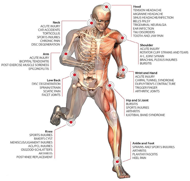 Laser Therapy